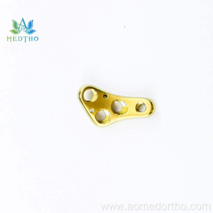 proximal femur locking plate